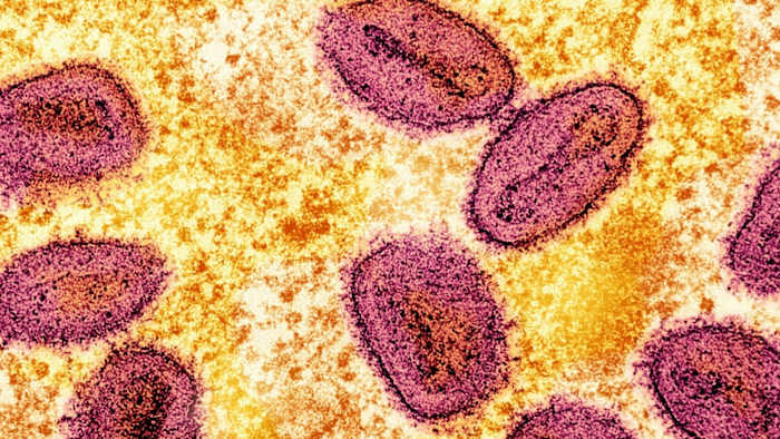 NIH scientists accused of smuggling monkeypox into US through Detroit Metro Airport