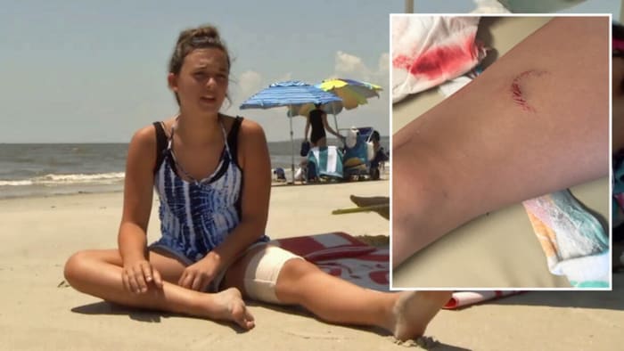 Tybee surf instructor back in the ocean two days after shark bite