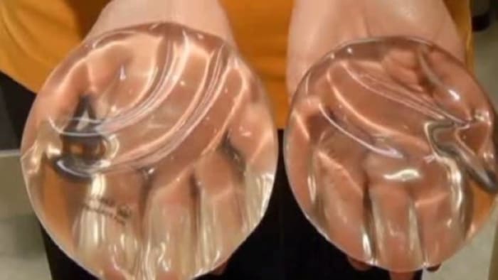 Breast Implants Gone Wrong: How Houstonians Can Easily Fix This Issue