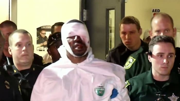 Markeith Loyd has 'multiple traumatic brain injuries,' attorneys say