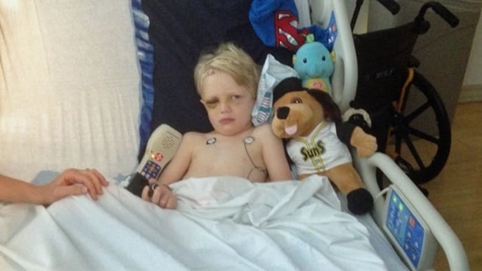 4-year-old recovering after being hit in head with baseball