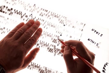 Man analyzes overlays on forensic chart