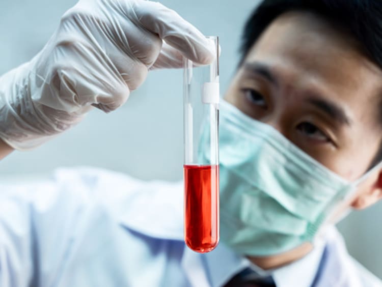 Toxicologist working in lab analyzing blood sample