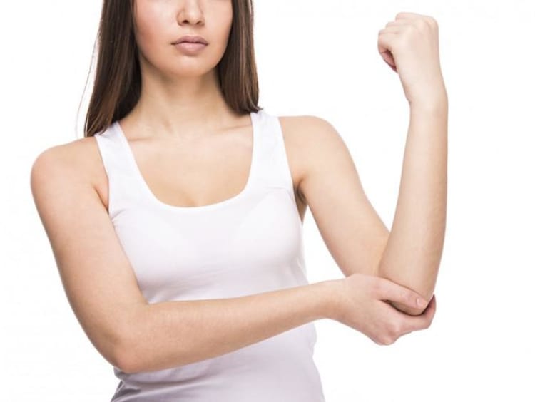 a girl holding up her elbow