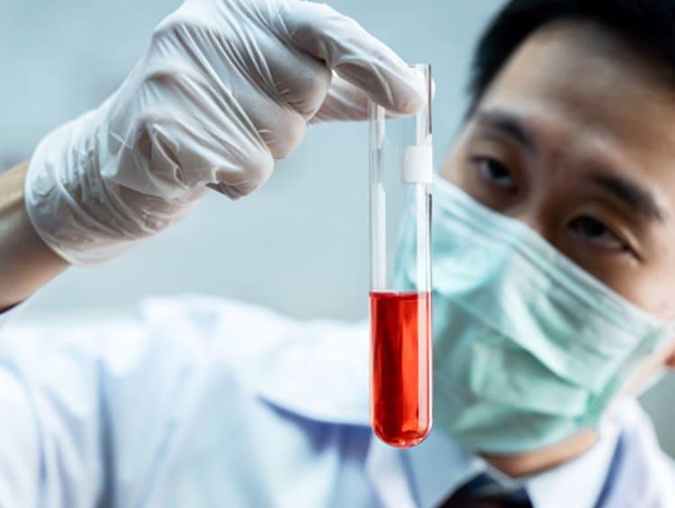 Toxicologist working in lab analyzing blood sample