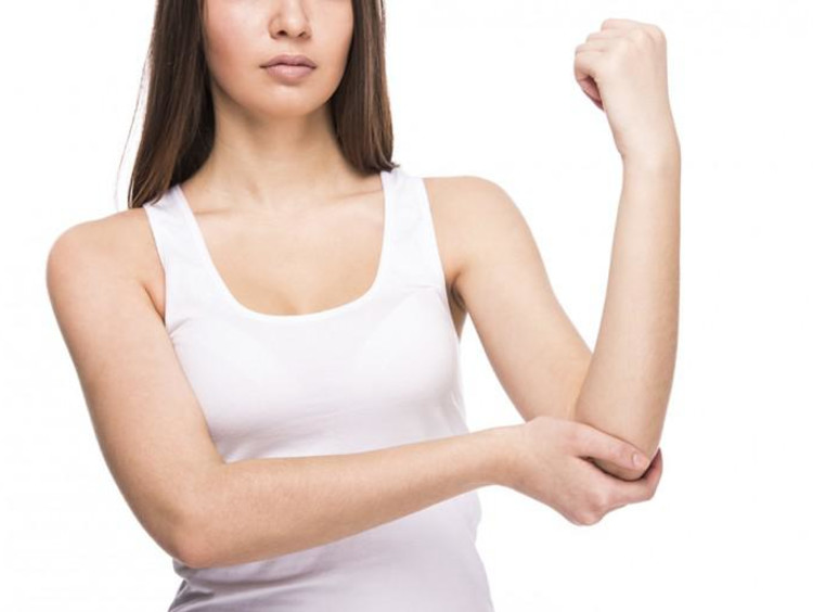 a girl holding up her elbow
