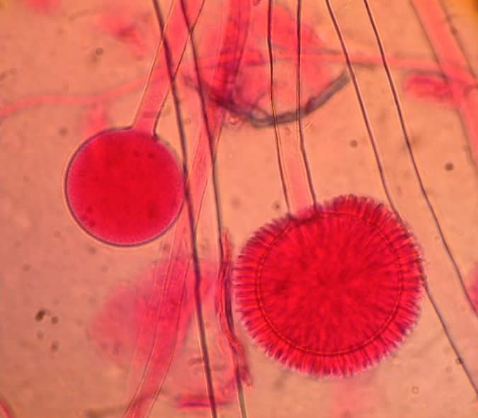 Aspergillus Niger auf Nährboden im mikrobiologischen Labor der LAFU GmbH | © LAFU GmbH