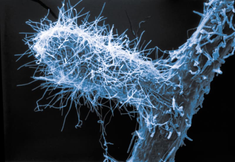 Mykorrhizapilz im Mikroskop