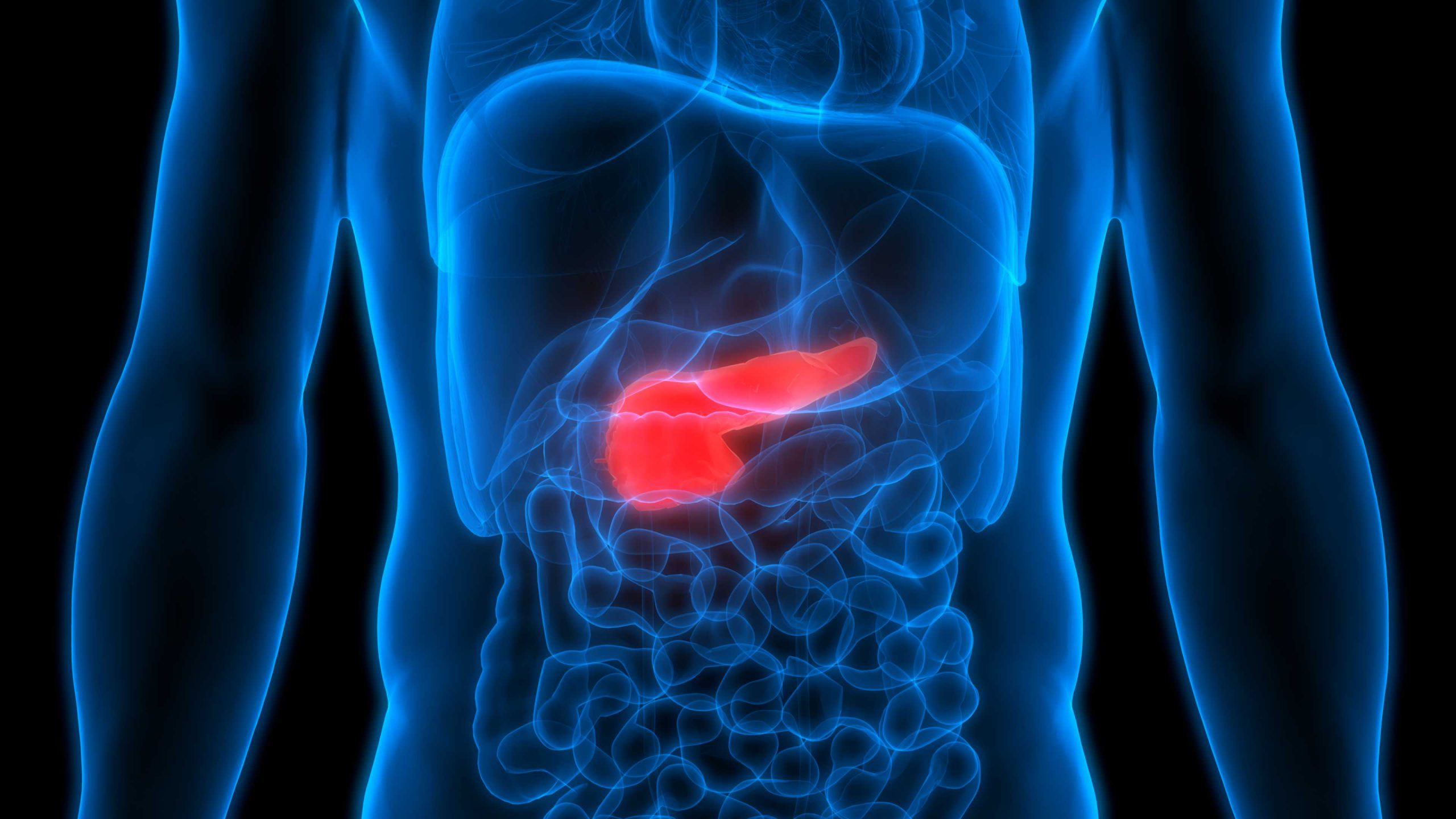 a diabetes pancreatitis