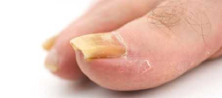 diabetes uk