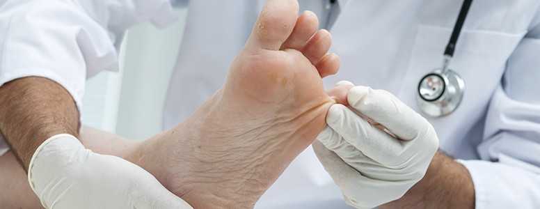 New Device Approved By Fda For Treatment Of Diabetic Foot Ulcers Diabetes Symptoms and signs of diabetic foot problems arise due to the decreased sensation from nerve damage as well as the lack of oxygen delivery to the people with diabetes are at increased risk for milder problems with the feet that are not specific to diabetes but may occur more frequently due to. treatment of diabetic foot ulcers