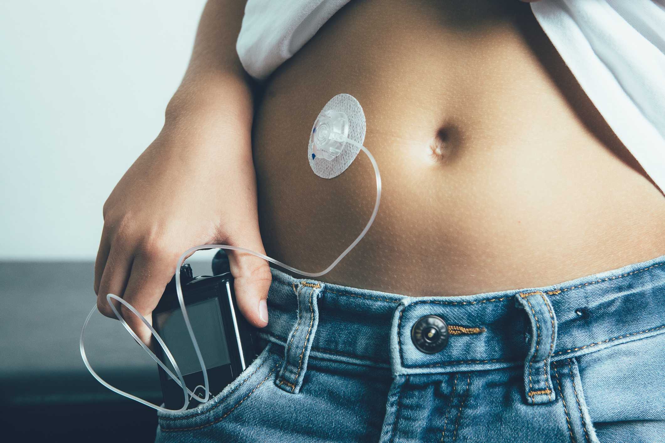 Insulin Pump Problems and Troubleshooting