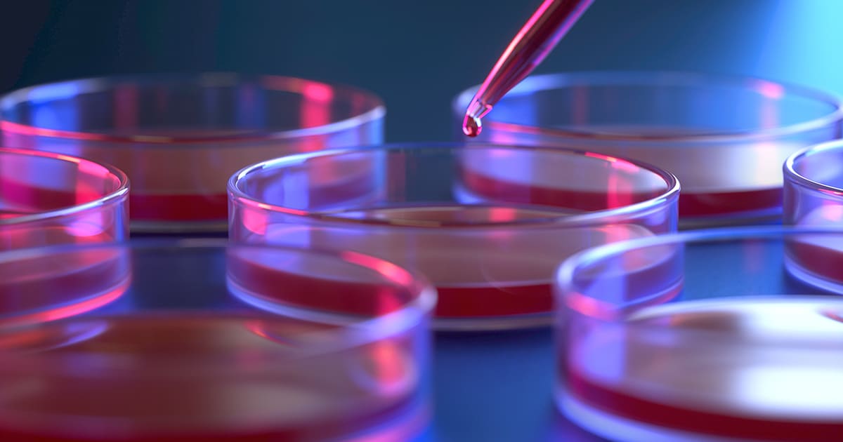 Best Natural Solutions For Stomach Ulcers Modern Holistic Health