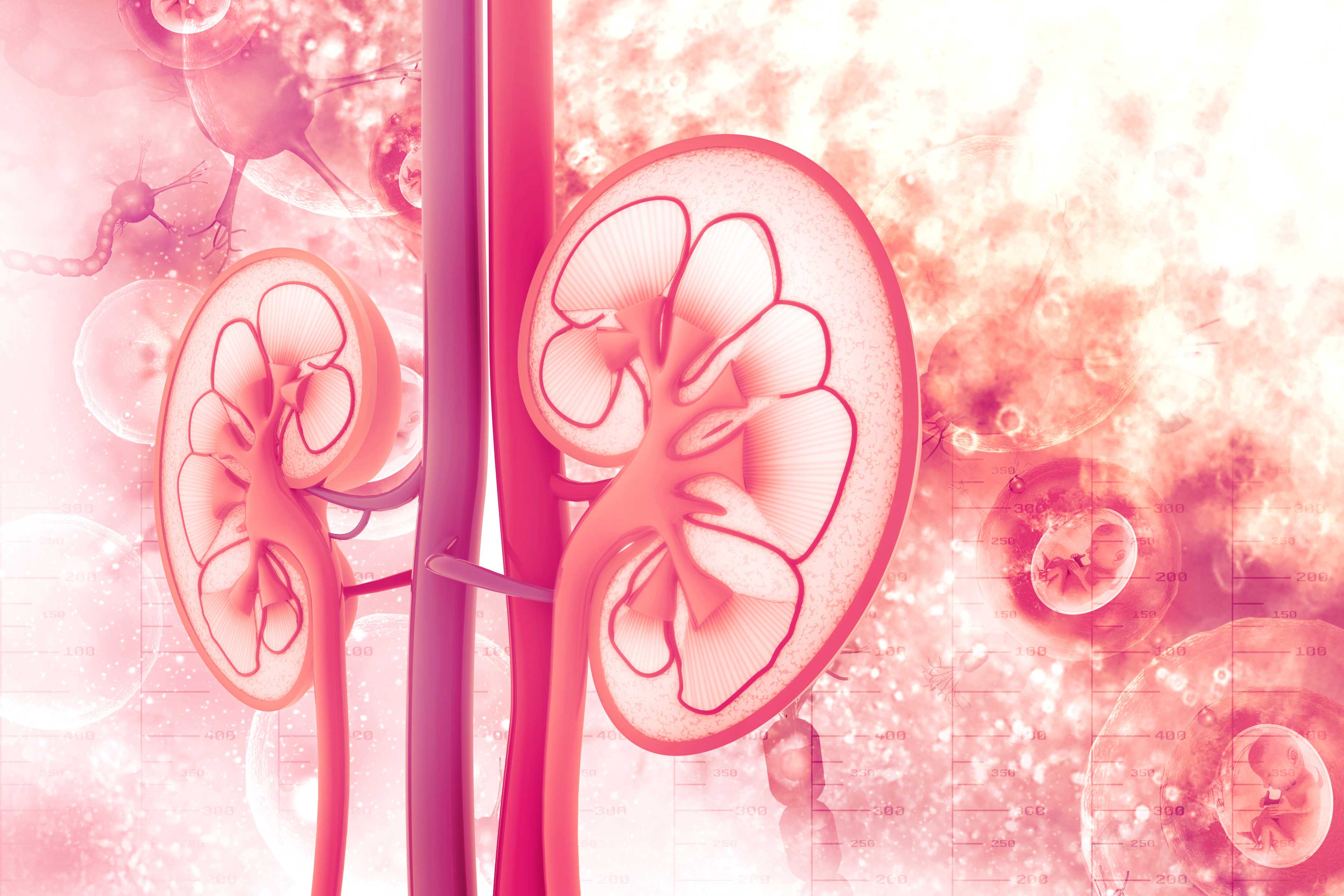 Kidney Dialysis Haemodialysis, Peritoneal dialysis & Periotonitis