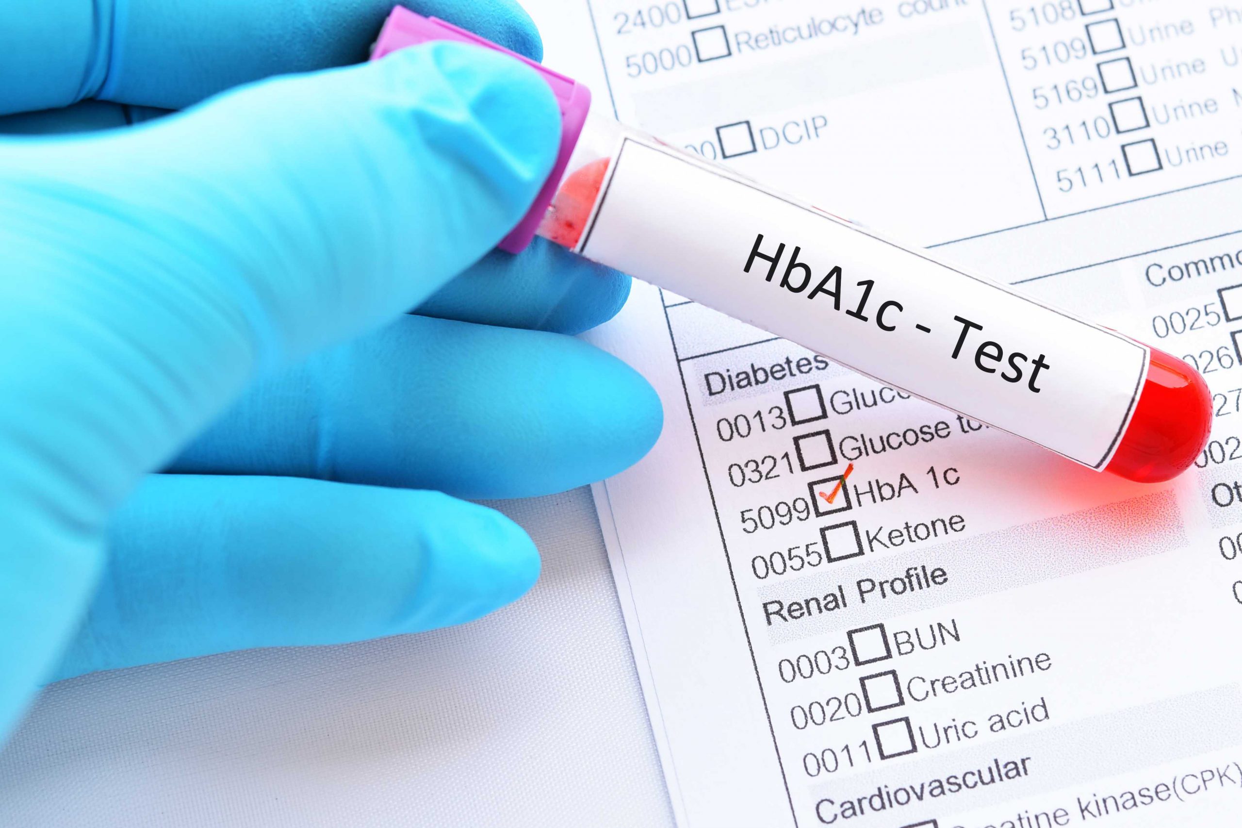 test for diabetes        <h3 class=