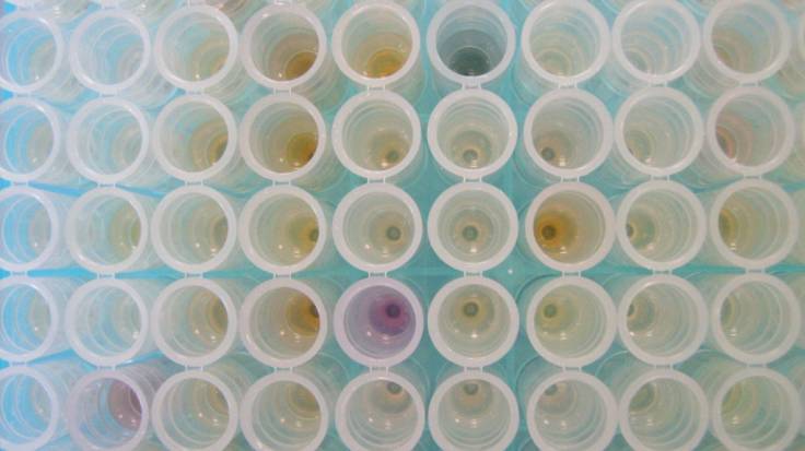 Rows of test tubes viewed from above