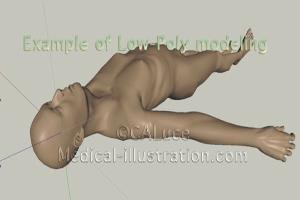 Portfolio for Medical Illustration