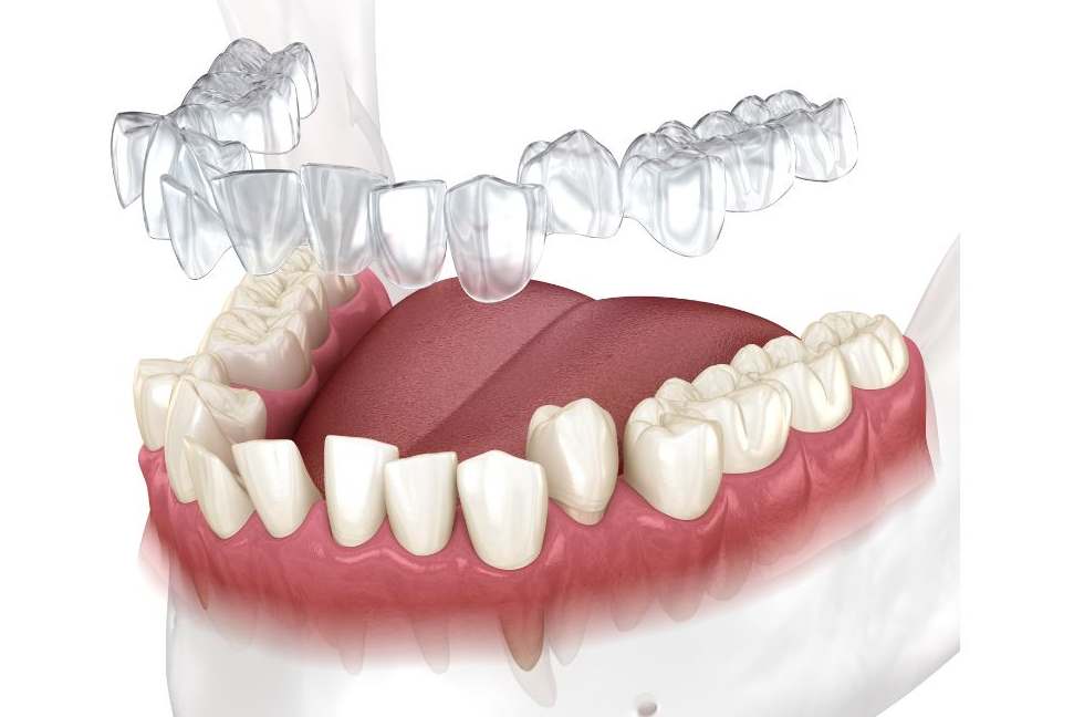 Portfolio for Dental Content Writing & Fact Checking