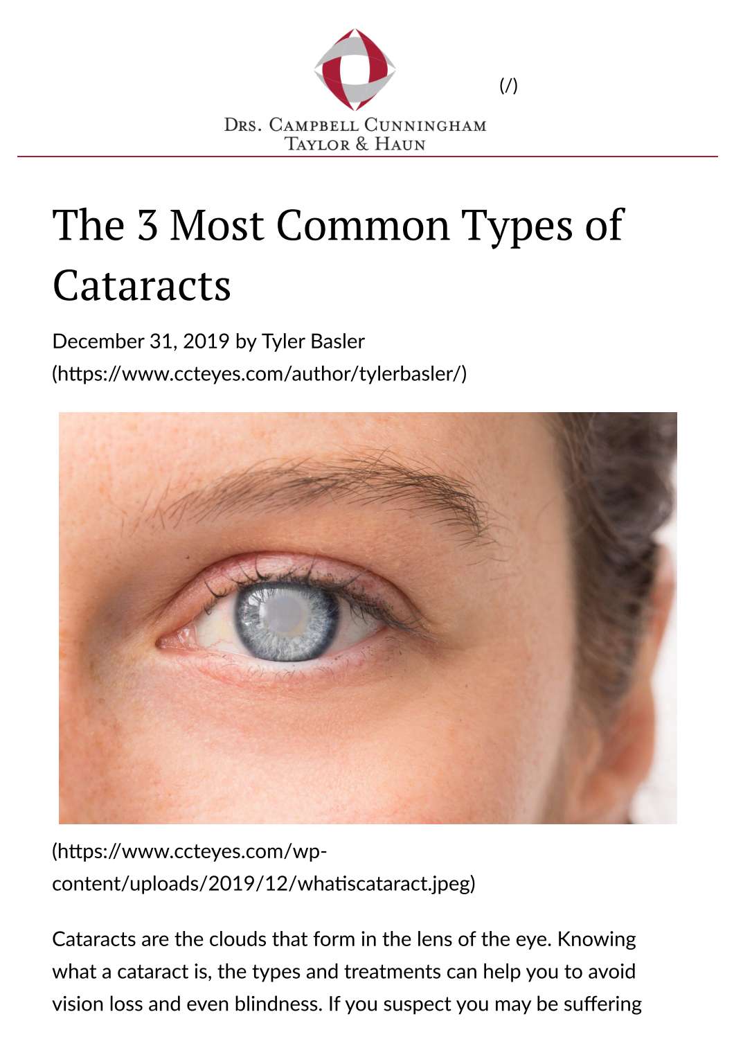 The 3 Most Common Types of Cataracts - Drs. Campbell, Cunningham, Taylor, and Haun.pdf