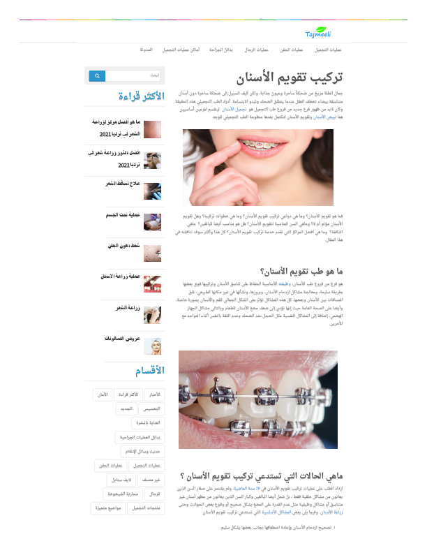 تركيب تقويم الأسنان.pdf