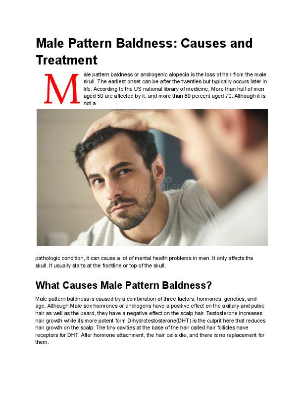 Male Pattern Baldness_Causes and Treatment (1).pdf