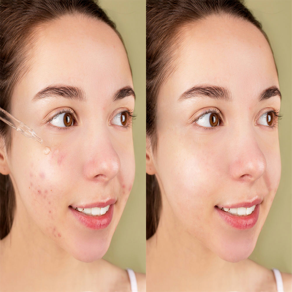 Retouching-skin-with-spot-healing-brush copy.pdf