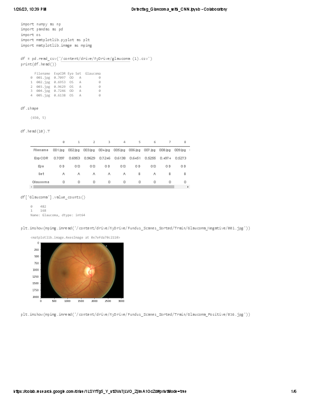 Detecting_Glaucoma_with_CNN.ipynb - Colaboratory.pdf