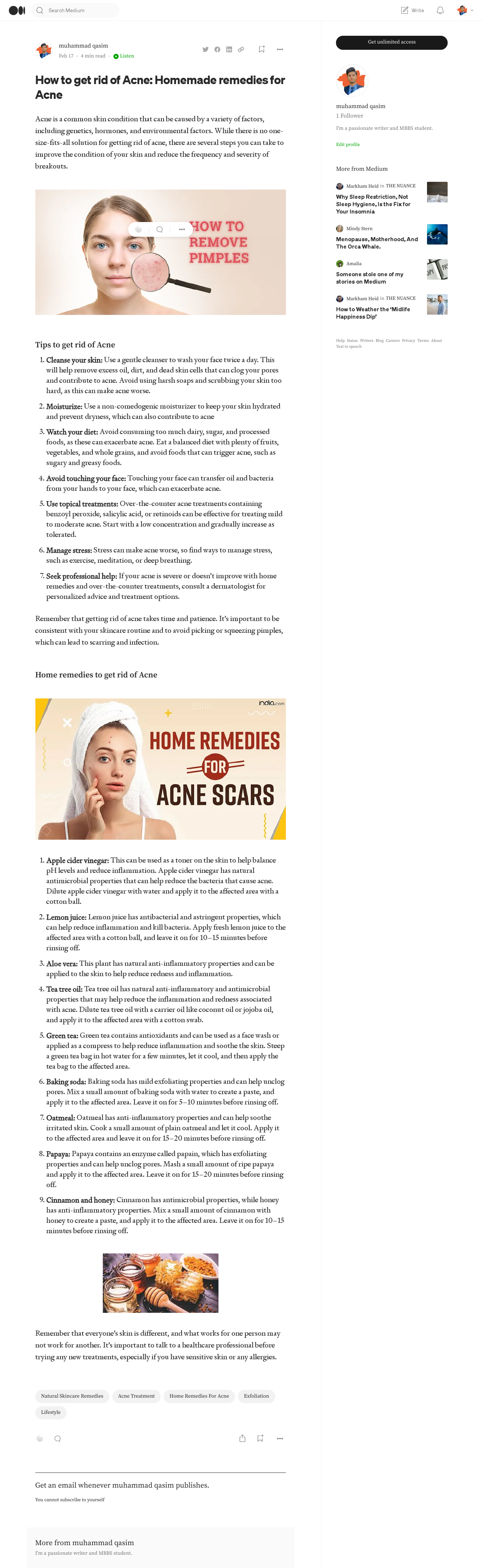 How to get rid of Acne_ Homemade remedies for Acne _ by muhammad qasim _ Feb, 2023 _ Medium.pdf
