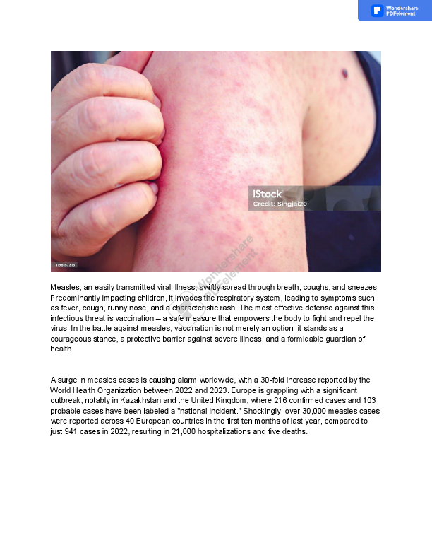 __The Measles Resurgence_ A Wake-Up Call for Global Health Vigilance_.pdf