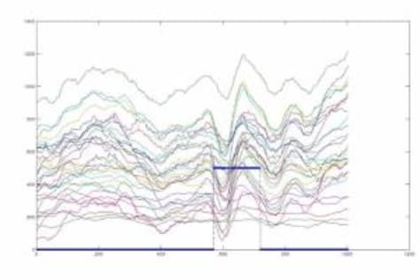 low pass filter for EEG