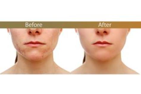 Images Editing/Retouching Samples