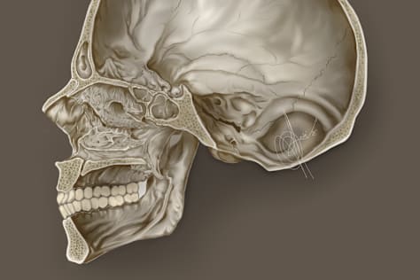 Medical Illustrations