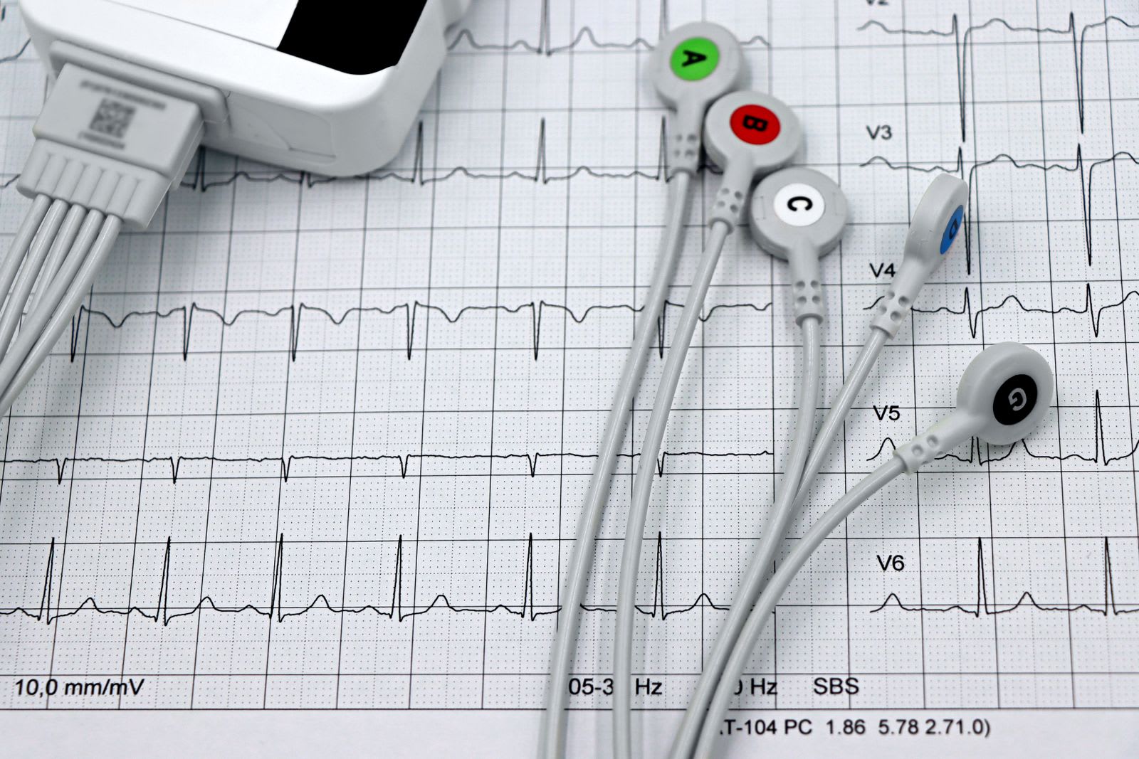 Grey ECG lead cables with coloured electrode clips lying across a printed 12-lead electrocardiogram trace.