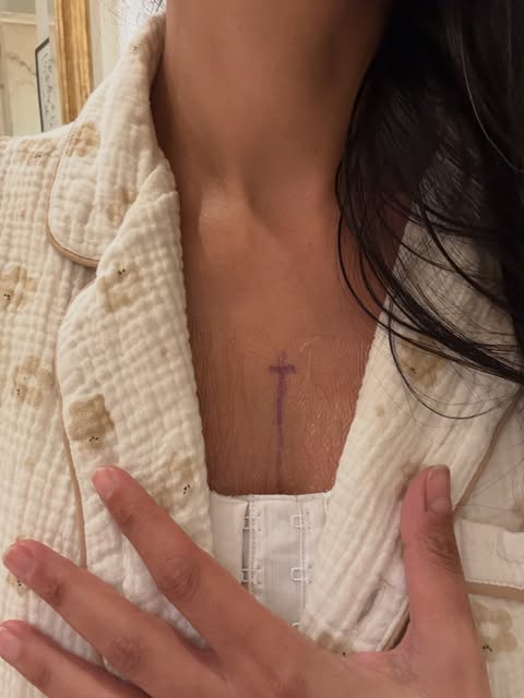 An Unexpected Cross ✡️✝️ I am a Jewish woman. And for the past two weeks, I have carried a cross on my chest.
My surgeon drew it during…