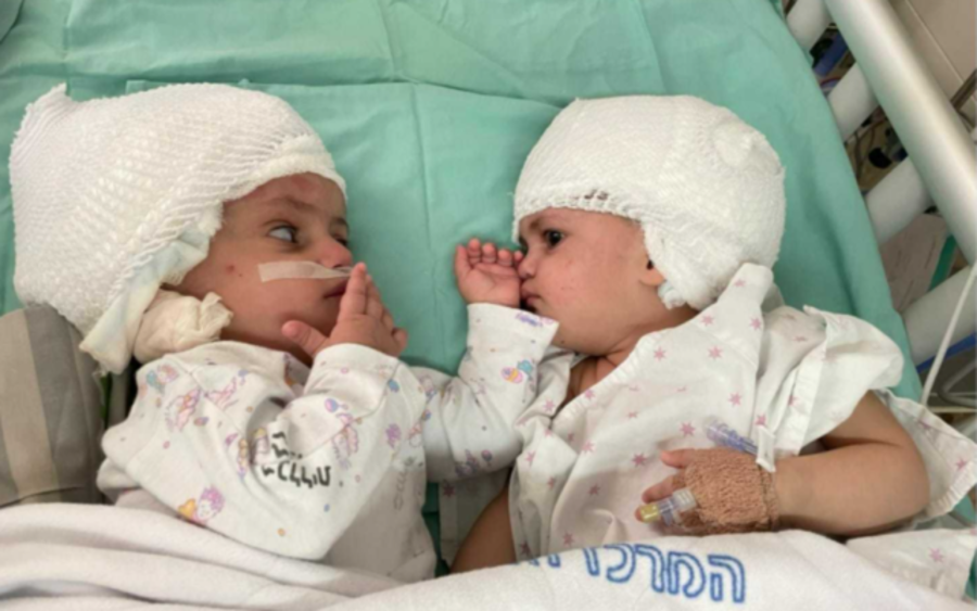 Conjoined twins, newly separated at Soroka University Medical Center in Beersheba, look at each other for the first time, Sept. 5, 2021. (Photo: Soroka University Medical Center in Beersheba)