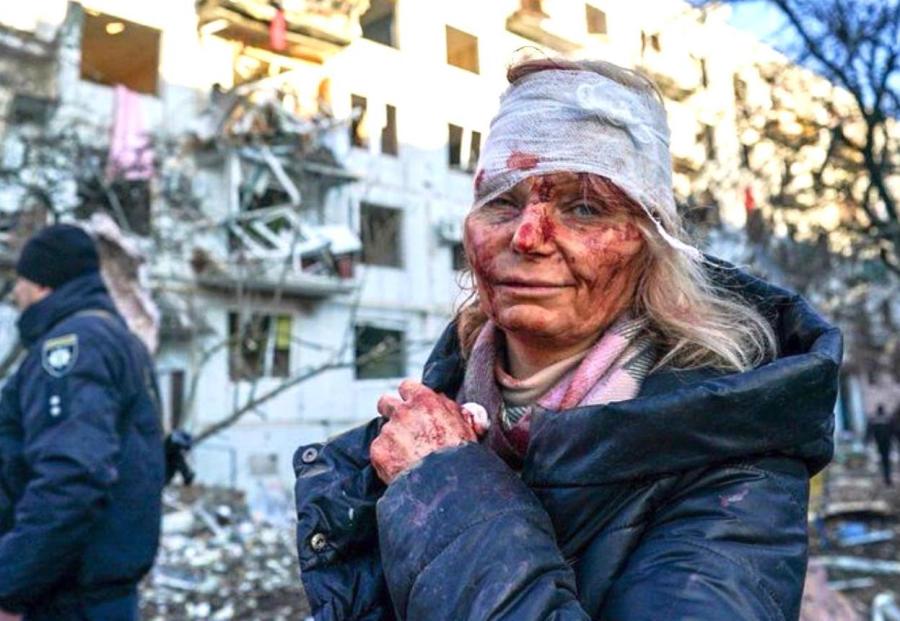 Woman injured in Russian bombing of a Ukrainian apartment building in Eastern Ukraine, Feb. 24, 2022 (photo credit: screenshot from Anadolu News Agency Twitter feed)
