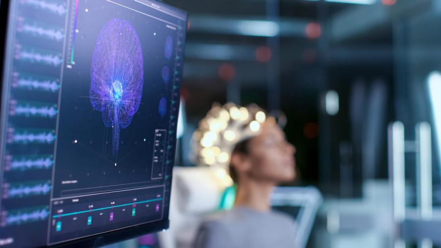 Illustrative image of a brain scan (Photo: Shutterstock)