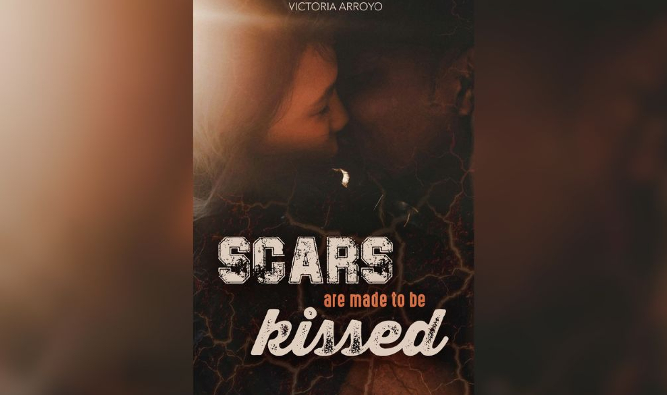 Scars are made to be kissed
