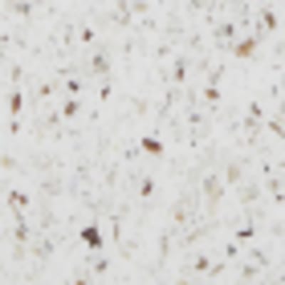 AS_Avonite_Alaskan_Stone_4312_Closeup