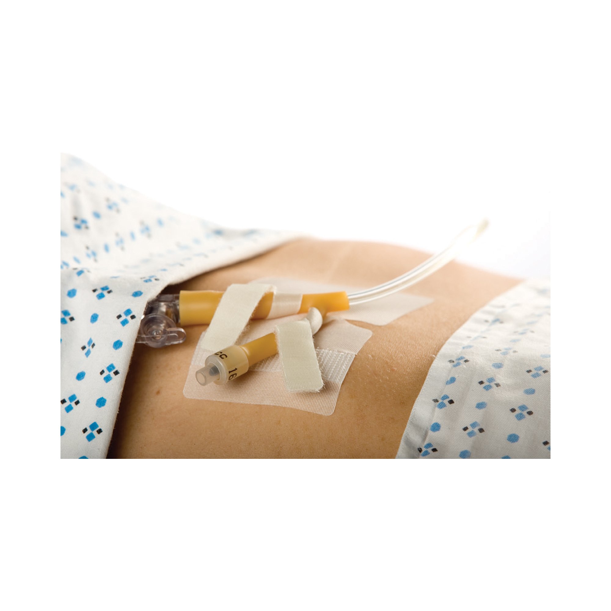 Cath-Secure Dual Tab Catheter Holder MK 785700