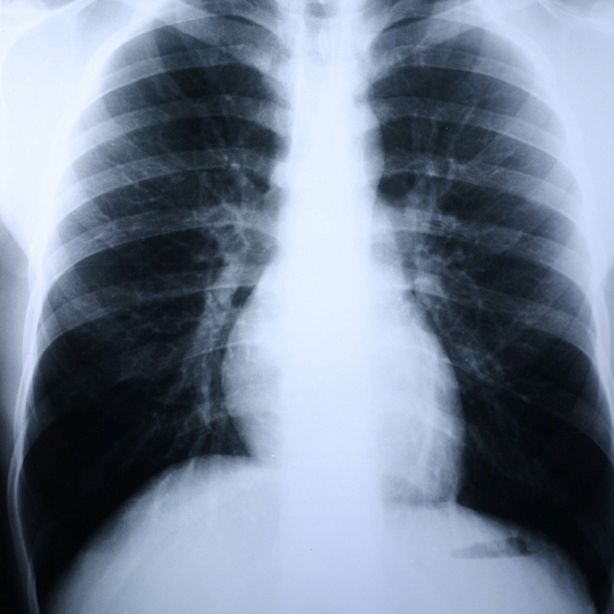 Clear Choice Performance X-Ray Film MK 456480