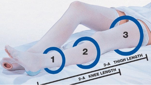 CAP Thigh High Anti-embolism Stockings, Extra Large / Short MK 637232