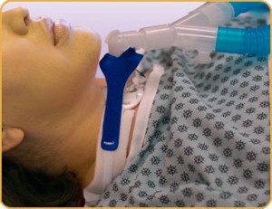 Vent Circuit Anti-Disconnect Device For Trach Ties Tracheostomy Tube MK 842533