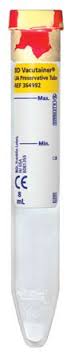 BD Vacutainer Urinalysis Tube, 16 x 100 mm, 8 mL MK 463696