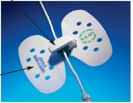 StatLock Stabilization Device MK 512998