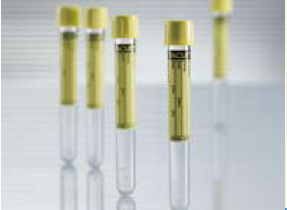Vacuette Urinalysis Tube, 6 mL, 13 x 100 mm MK 507448