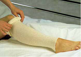 AlbaHealth Natural Cotton Tubular Stockinette, 3 Inch x 25 Yard MK 243650