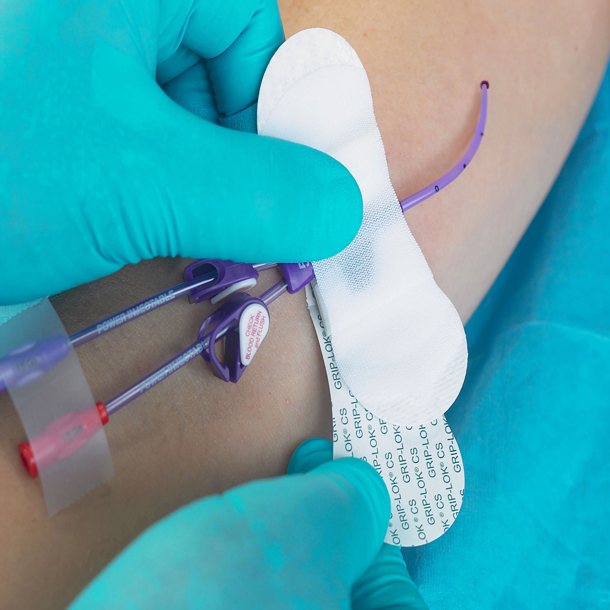 Catheter / Line Securement Device Grip-Lok MK 1137875