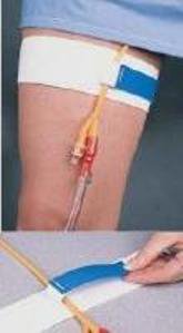 Cath-Mate  II Leg Stap MK 345357