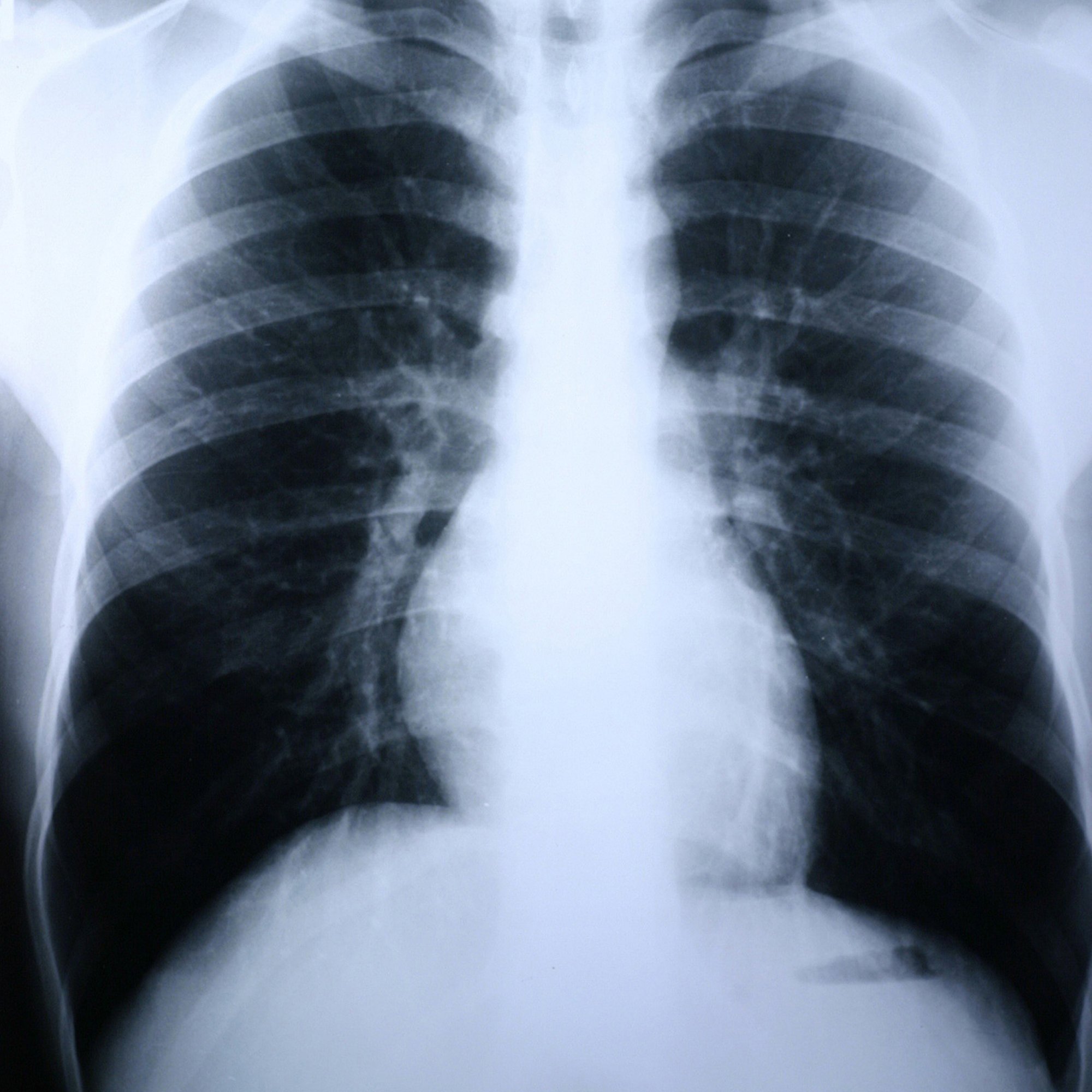 Clear Choice Performance X-Ray Film MK 456489